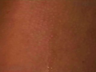 Tick Zoofilia